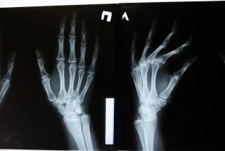bones