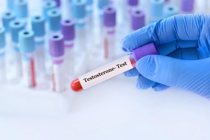 Doctors Warn That Testosterone-Booster Supplements May Be Harming Your Heart — What the Science Says